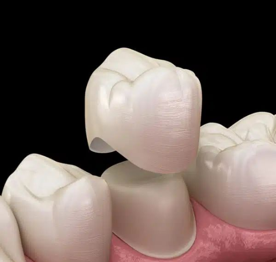 Root Canal Treatment